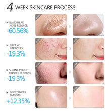 Load image into Gallery viewer, Blackhead Remover Salicylic Acid Face Mask Facial Cleansing Against Black Dots Acne White Clay Mask Cream Skincare Cosmetics