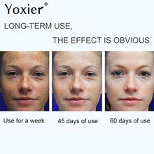 Load image into Gallery viewer, Dark Spot Correction Cream Remove Spots Body Pigmentation Face Cream Uneven Skin Tone Whitening Brightening Skin Care 30g

