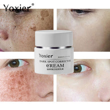 Load image into Gallery viewer, Dark Spot Correction Cream Remove Spots Body Pigmentation Face Cream Uneven Skin Tone Whitening Brightening Skin Care 30g

