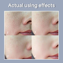 Load image into Gallery viewer, Lactobionic Acid Pore Shrink Face Serum Hyaluronic Acid Moisturizing Nourish Essence Firming Brighten Korean Skin Care Products
