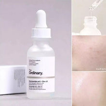 Load image into Gallery viewer, Wholesale Ordinary Serum Ordinary Niacinamide 10% Zinc 1% Whitening Vitamin C Hyaluronic Acid Serum Whitening Essence 30ML
