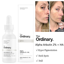 Load image into Gallery viewer, Wholesale Ordinary Serum Ordinary Niacinamide 10% Zinc 1% Whitening Vitamin C Hyaluronic Acid Serum Whitening Essence 30ML

